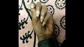 Moha Nail and Foot care creams