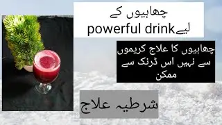 beetroot drink for freckles\ power drink for increasing hb\very effective remedy