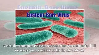 A Natural Remedy for Epstein Barr Virus That Works!