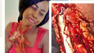 SPECIAL EFFECTS OF A BROKEN LEG FOR STARTERS || SFX MAKE UP TUTORIAL || HALLOWEEN MAKE UP