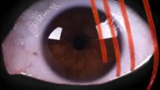TERROR - BRXINLESS