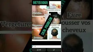forever Living products#skin problem#short video#trending short#flp India l