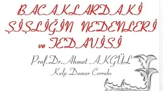 Ayak AYAK BİLEĞİ neden şişer BACAKTA NEDEN ŞİŞLİK OLUŞUR - Prof. Dr. Ahmet AKGÜL