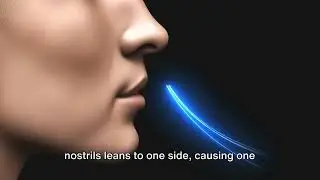 Understanding deviation of nasal septum
