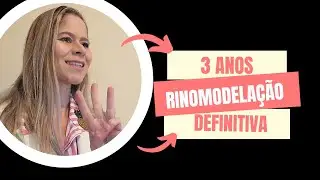 Meus 3 anos de rinomodelação definitiva
