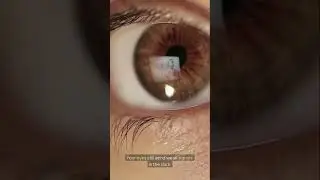 Why You 