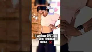 Targeted Exercises for Umbilical Hernia & Diastasis Recti Relief