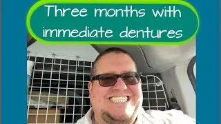 Three months with immediate dentures. Dentures at 35!