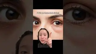 belif Aqua Bomb Cooling Eye Gel feels soooo soothing! A must have for dark circles and puffiness✨