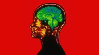Stop Overthinking &mdash; It&rsquo;s Destroying Your Life Faster Than You Think