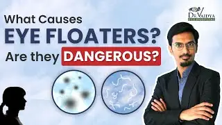 What are EYE FLOATERS? Causes, Risks & Treatment | Vitrectomy | Dr. Harshit Vaidya