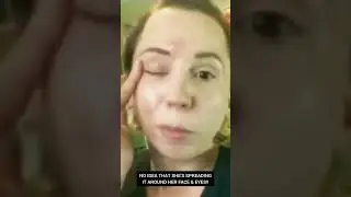 CONVINCED DOCTOR SHE HAD A SINUS INFECTION - WITHOUT A CRYSTAL BALL - AUG 2020 #withoutacrystalball
