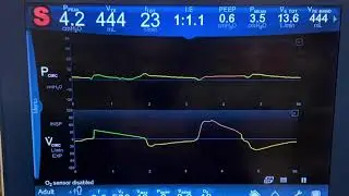 RESP 2650 Lab Module A - SIMV