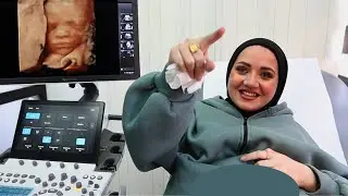 اول مرة نشوف البيبي!!😢