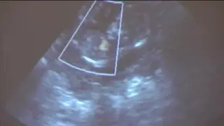 Medical professional refutes lawmaker&rsquo;s ectopic relocation claim