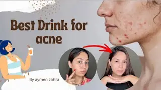 Drink for acne | Aymen zahra | transformation series ep 15