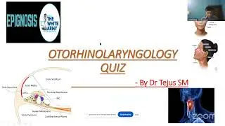 EPIGNOSIS - ENT Quiz 2026 Final Round