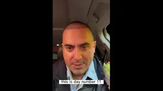 11-day FUE hair transplant update. Dr. Cortez Tijuana Mexico. Capilar Hair Center