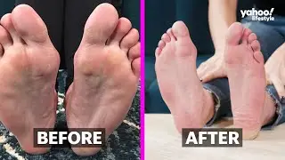 Baby Foot Review: We Tested the Foot Peel Mask That Removes Dead Skin | Hook'd | Yahoo! Lifestyle
