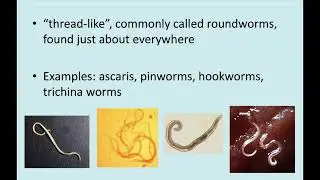 Destroy Parasites: Help Remove Nematodes : 771 hz Beta : Isochronic tone