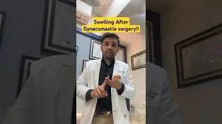 Seroma After Gynecomastia Surgery? Complication Explained by Dr Dhruv Chavan #gynecomastiatreatment