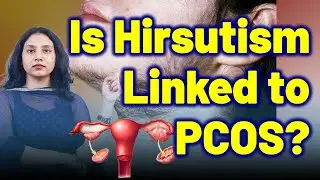 Facial Hair, Female Beard Growth, Hirsutism Is PCOS the Only Cause ? | Treatment Cure | Gynaecology