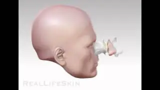 RealLifeSkin Nose Prosthesis