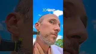 Да, это может спасти вашу кожу!