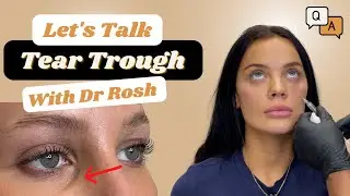 Tear Trough| Everything you NEED to know about Under Eye Filler with Dr Rosh