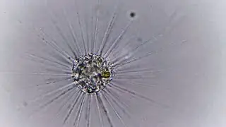 Heliozoa: Actinosphaerium