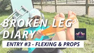 Broken Leg Diary #3   Flex and Props