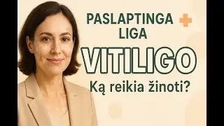 Paslaptinga liga - vitiligo: ką reikia apie ją žinoti