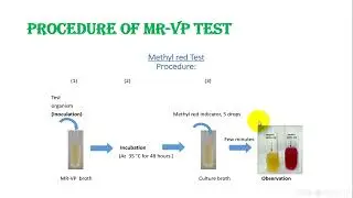 Practical Diagnostic Microbiology 1   Lab 4   IMViC Test   MR VP Test