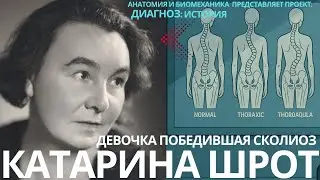 Катарина Шрот: девочка победившая сколиоз. Диагнози история.