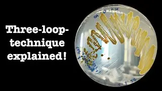 Streak plate technique | Lab demo | Microbiology