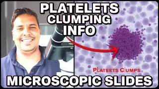 What is clumps platelets