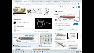 LECTURE #10 Phylum NEMERTEA & Phylum GASTROTRICHA #invertebrates #zoology Miller & Harley Book Ch.10