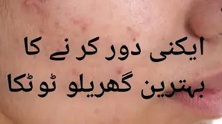 Acne, Dag,Dany ke li/Acne Remove Pmples Naturally