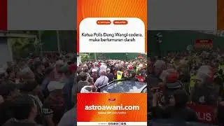 Ketua Polis Dang Wangi cedera, muka berlumuran darah
