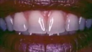 LVI Smile Cosmetic Dentists 3