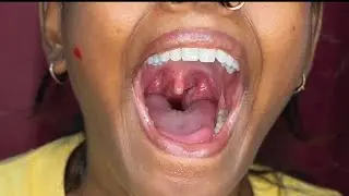👄 Close-Up Mouth Tour | Every Detail Revealed! #MouthTour #CloseUp #Teeth #Smile #OralHealth #Dental