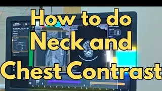 CT Scan Protocol: How to Perform Neck & Chest Contrast Study | Siemens Somatom go
