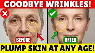 Rejuvenate Your Skin While You Sleep: The Real Formula | Frank Su&aacute;rez