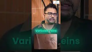Radiologist vs Interventional Radiologist What&rsquo;s the Difference? | Dr. Rajah V. Koppala