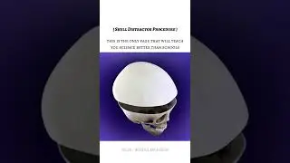 Skull Distractor Procedure