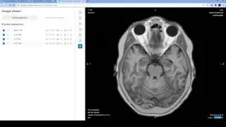 Brain protocol in a virtual MRI Simulator