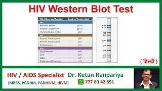 Understanding the HIV Western Blot Test: Accuracy, Results & What it Means for You
