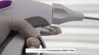 LigaSure Vessel Sealing System