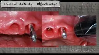 How do you know an implant is ready to be restored?
