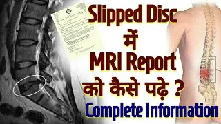 How To Read MRI Report Of SLIPPED DISC  / L4-L5 L5-S1 Sipped Disc DIAGNOSIS / In Hindi